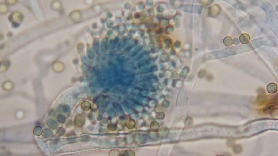 Aspergillus flavus
