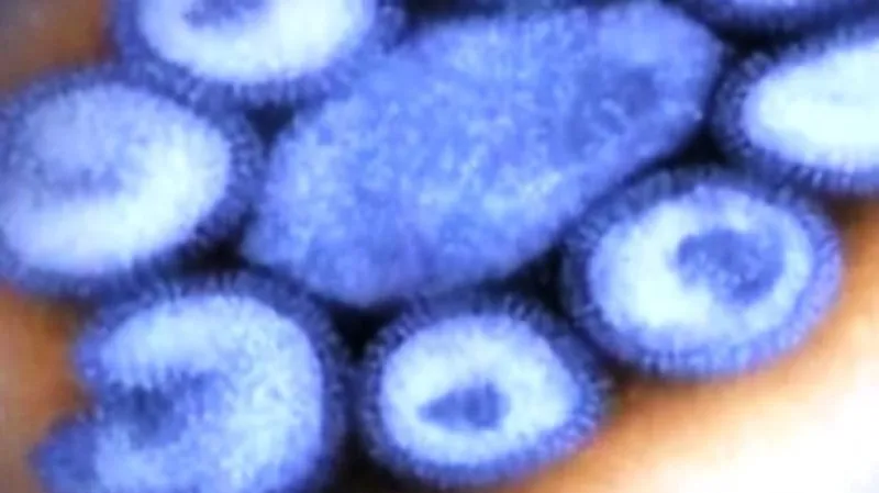 Virus chřipky A (H1N1)
