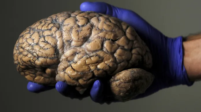 Lidský mozek v rukou belgického výzkumníka Jeroena Schuermanse. Jde o součást kolekce tří tisíc lidských mozků, které by měly výzkumníkům poskytnout hlubší vhled do podstaty psychických onemocnění na psychiatrii v belgickém městě Duffel.