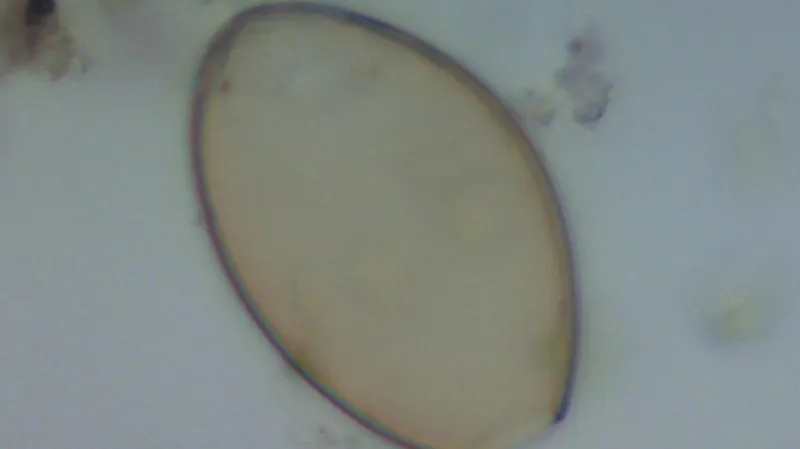 Vajíčko škulovce širokého