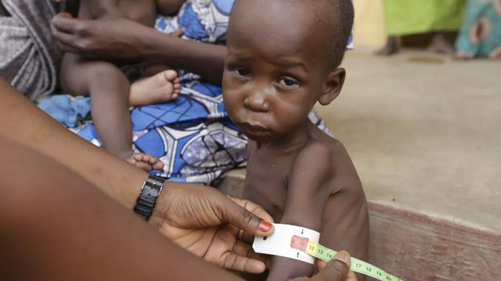 Děti v Nigérii trpí hladem