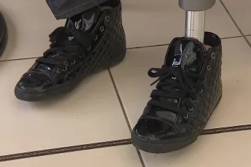 Ubylo amputací nohou kvůli neuropatii. Rozpoznat se dá i ladičkou