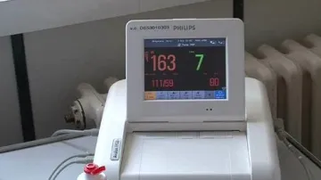 Brněnská nemocnice získala unikátní monitorovací systém