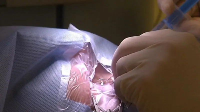 Události: Péče o lidi po transplantaci