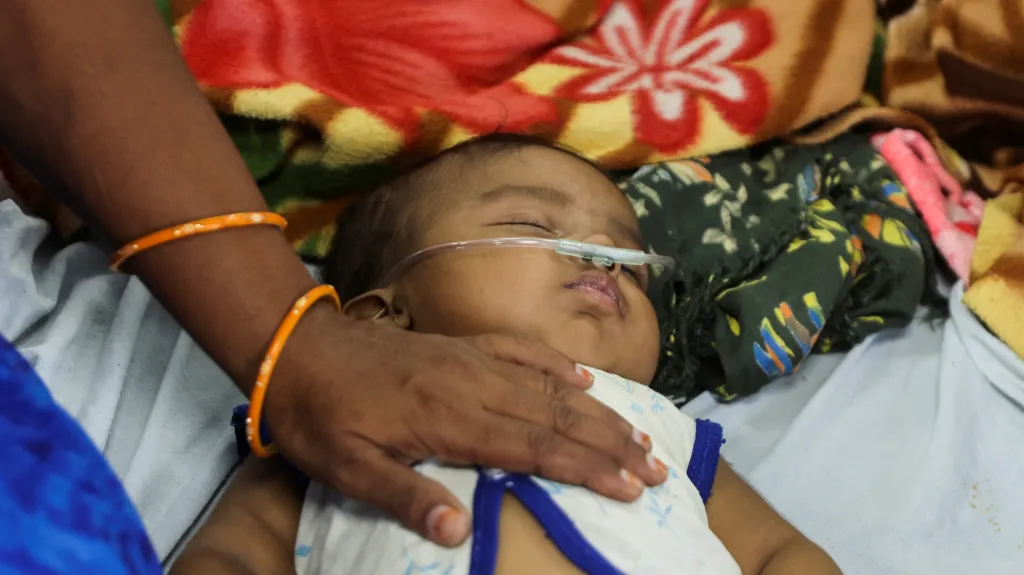 Dítě hospitalizované se zápalem plic v Indii