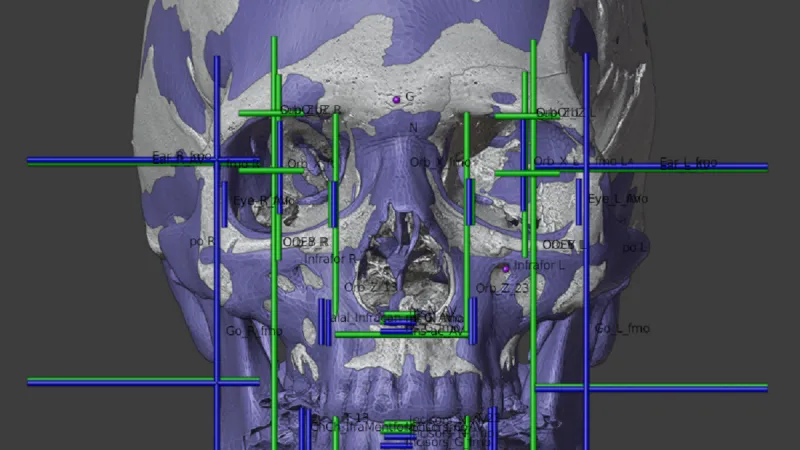 Postup rekonstrukce tváře svatého Vojtěcha