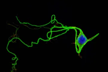 Gen pro nervová spojení souvisí s autismem