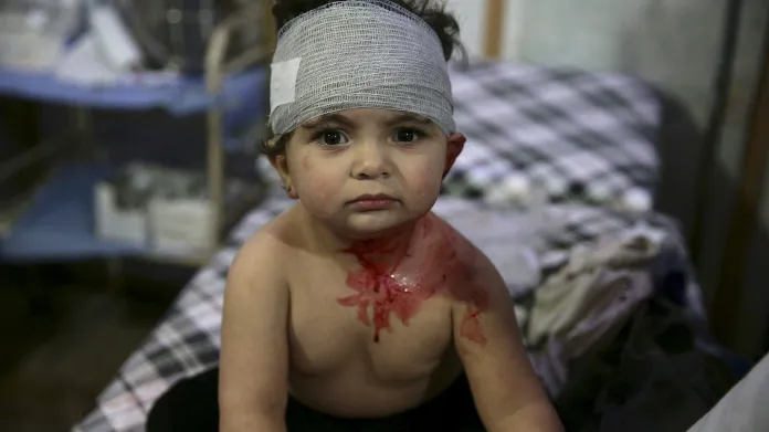 Dětské oběti syrské války