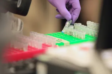 Některých infekcí přibylo, žloutenky A více než desetkrát, uvedl zdravotní ústav