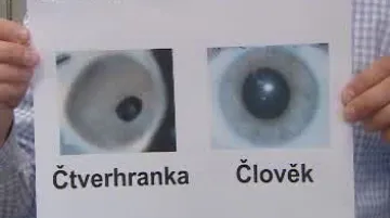 Oko člověka a medúzy