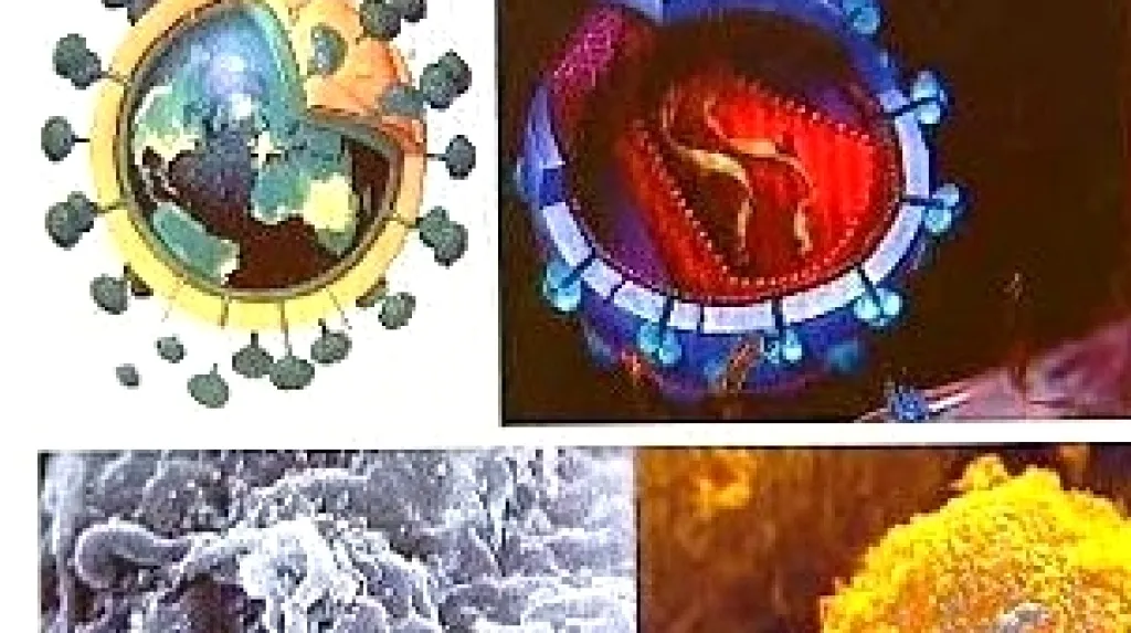 Virus HIV