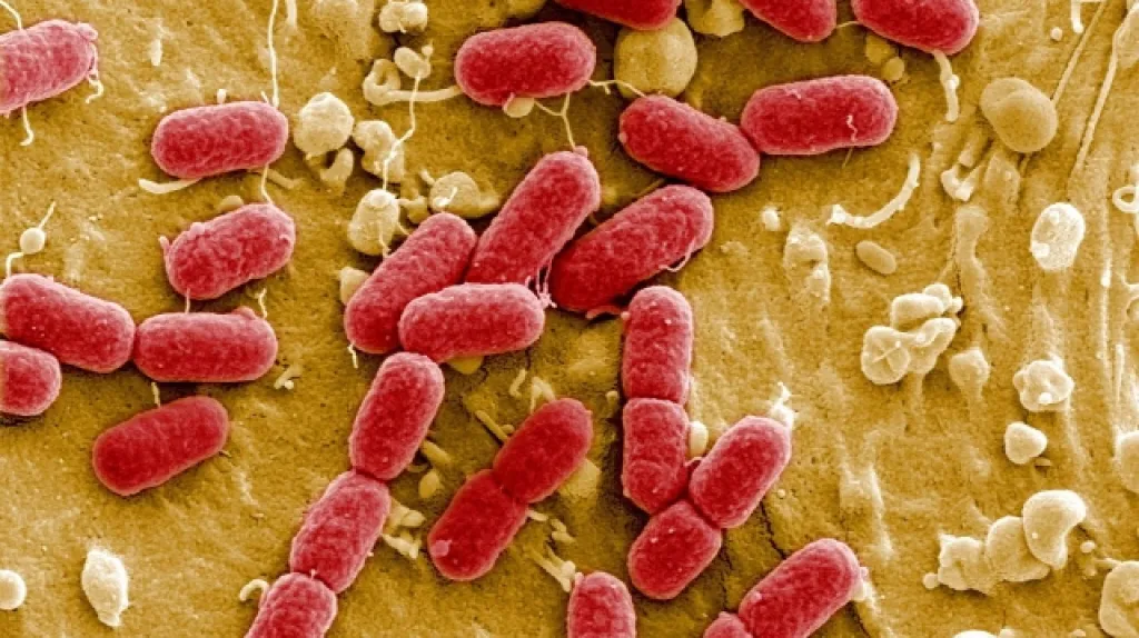 Enterohemoragická E.coli