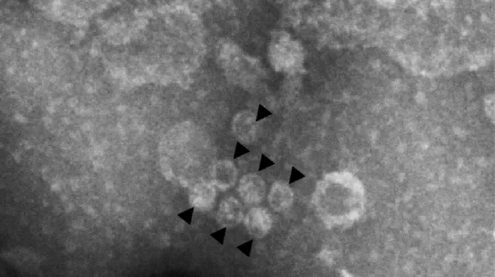 Snímek z elektronového mikroskopu, zachycující pravděpodobné částice jednoho ze tří objevených virů
