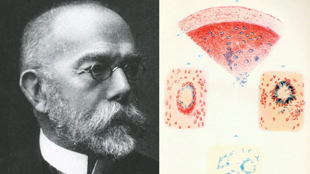 Robert Koch a ukázka z jeho práce