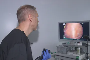 Preventivní vyšetření střev bude zdarma už od pětačtyřiceti let