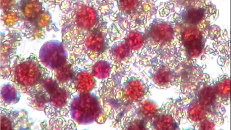 Řasy pod mikroskopem