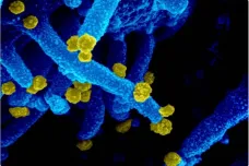 Vědci řeší, jestli by se koronavirus nemohl úplně vyhnout lidskému imunitnímu systému