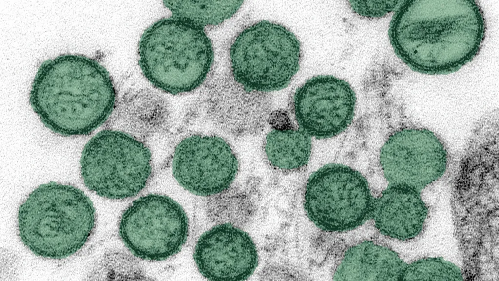 Hantavirus