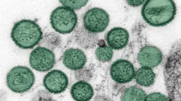 Hantavirus