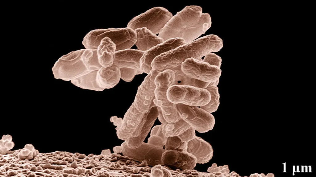 Escherichia Coli