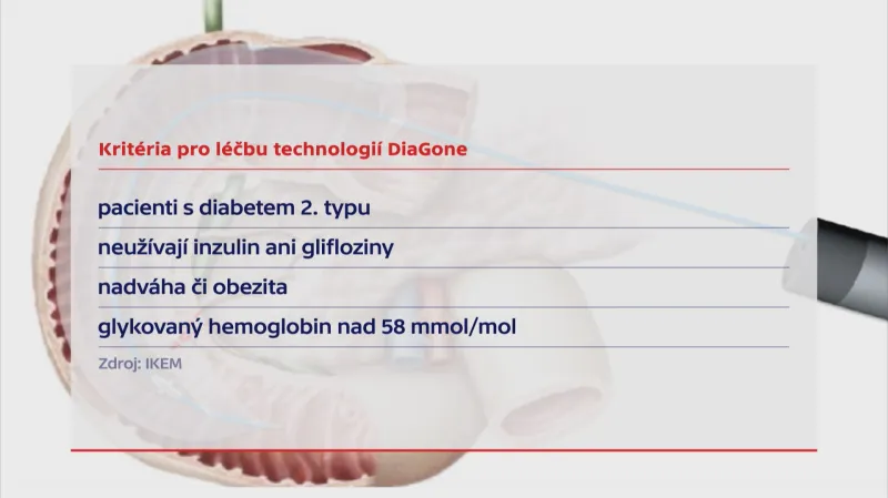 Kritéria pro léčbu