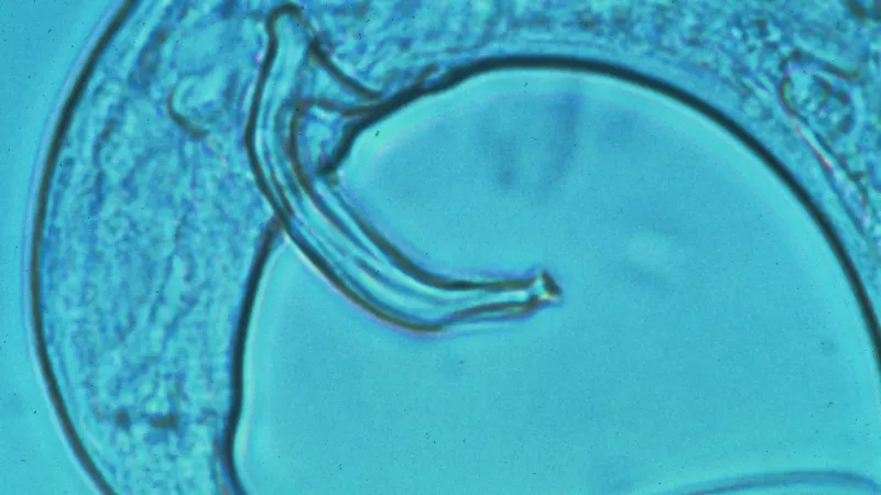 Háďátko borové měří kolem půl milimetru