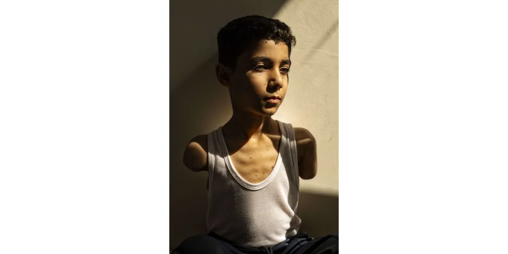 Vítězná fotografie World Press Photo 2025 – Mahmúd Ajjour, devět let (Mahmoud Ajjour, Aged Nine) – Když jeho rodina prchala před izraelským útokem, Mahmúd se otočil a pobízel ostatní, aby pokračovali dál. Při explozi o jednu paži přišel a druhou mu zmrzačila. Rodina byla evakuována do Kataru, kde se Mahmúd po lékařském ošetření učí používat nohy k hraní her na telefonu, psaní a otevírání dveří. Kromě toho potřebuje zvláštní pomoc při většině každodenních činností – třeba oblékání či jídle
