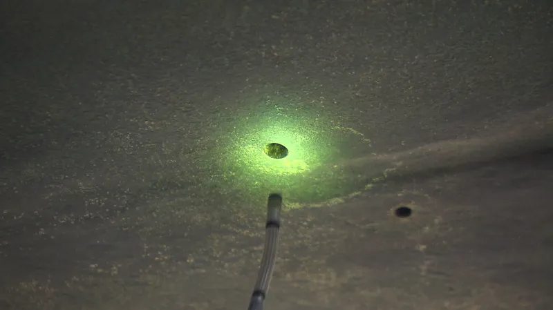 Endoskopická sonda mířící do útrob koně sochy svatého Václavy