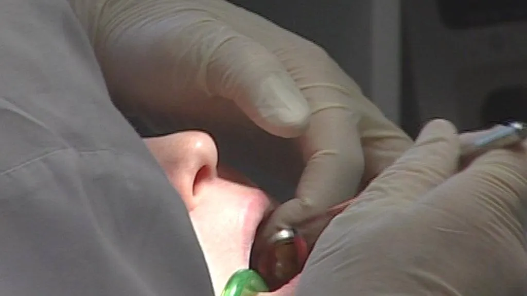 Vyšetření u zubaře