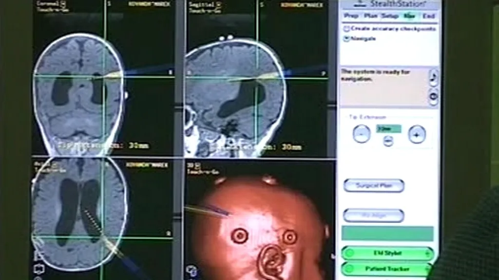 Elektromagnetická navigace