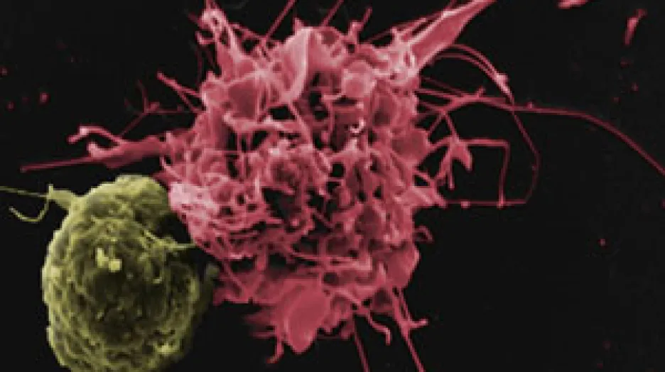 Dendritická buňka (vpravo) napomáhající T lymfocytu