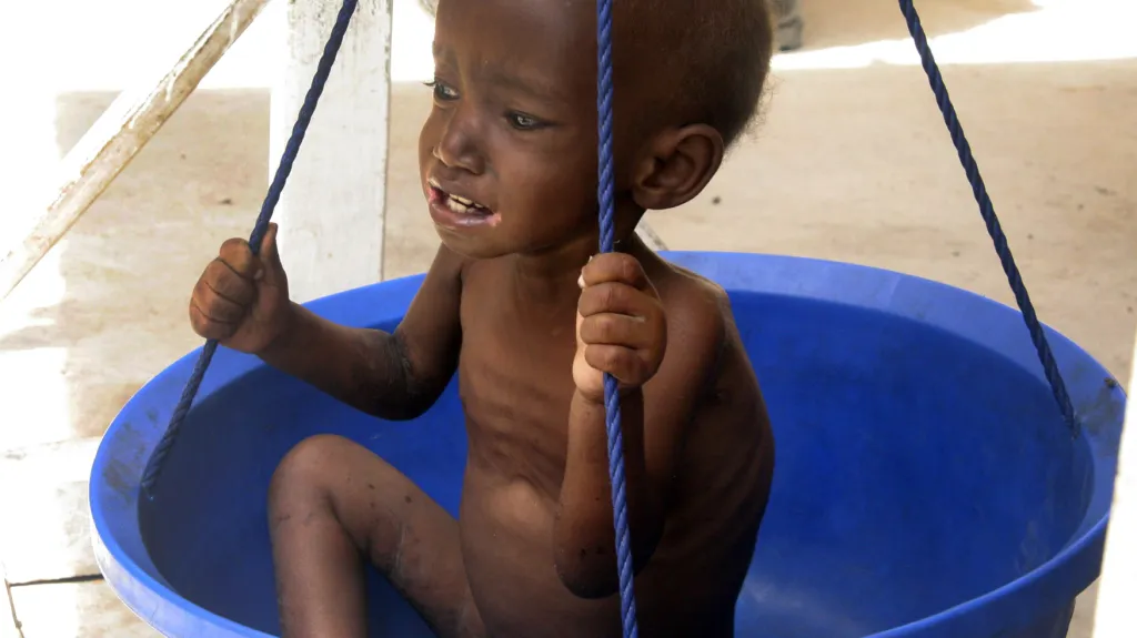 Podvyživené somálské dítě - snímek z roku 2011
