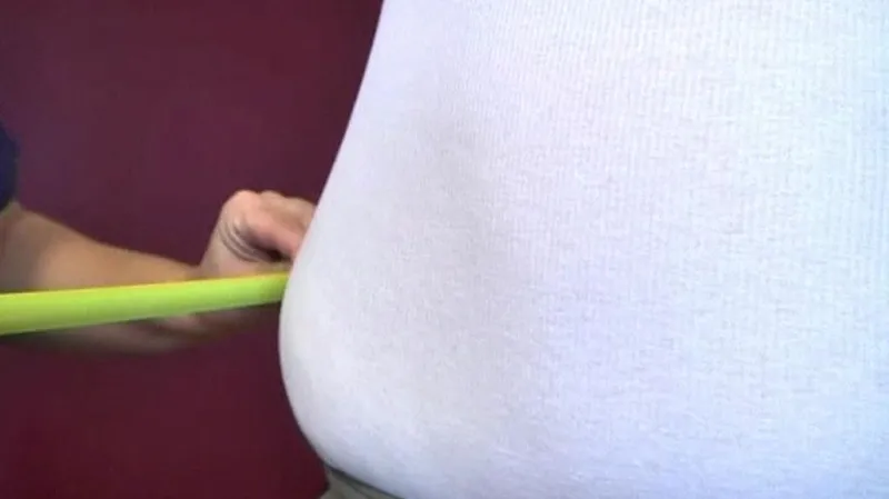 Obezita