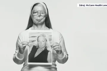 Útoků kyselinou na světě přibývá. Kampaň upozorňuje na odpovědnost textilního průmyslu