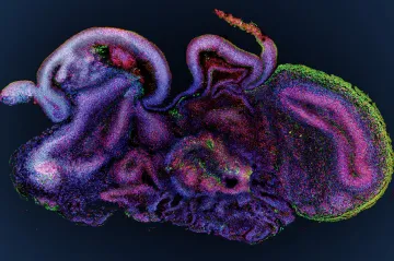 Brněnští vědci zkoumají příčiny Alzheimerovy choroby na miniaturních lidských „mozečcích“