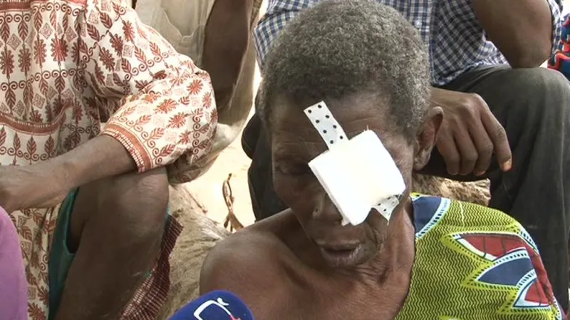 Pacient oční kliniky v Zorghu v Burkině Faso