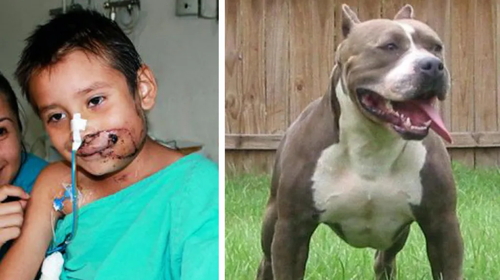 Raúl Carrizales po operaci obličeje