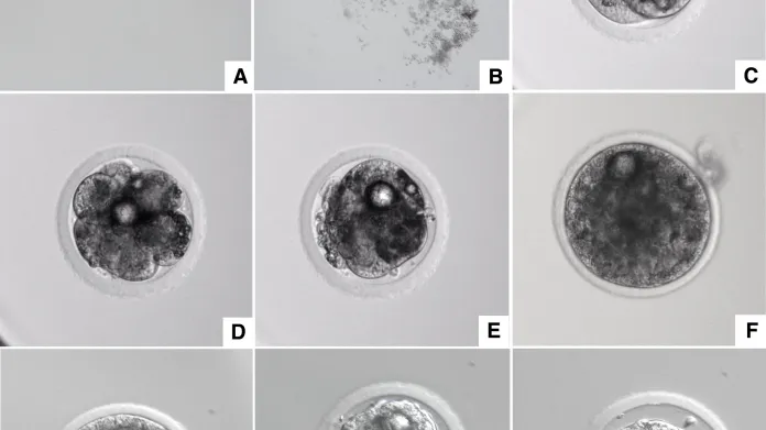 Vývoj embrya