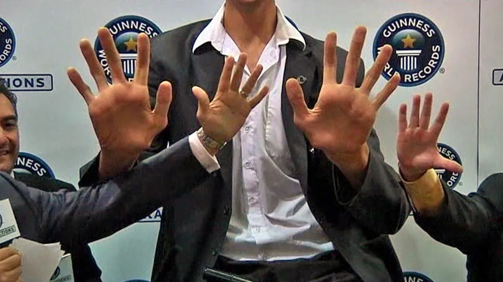 Ruce Sultana Kösena, nejvyššího muže světa