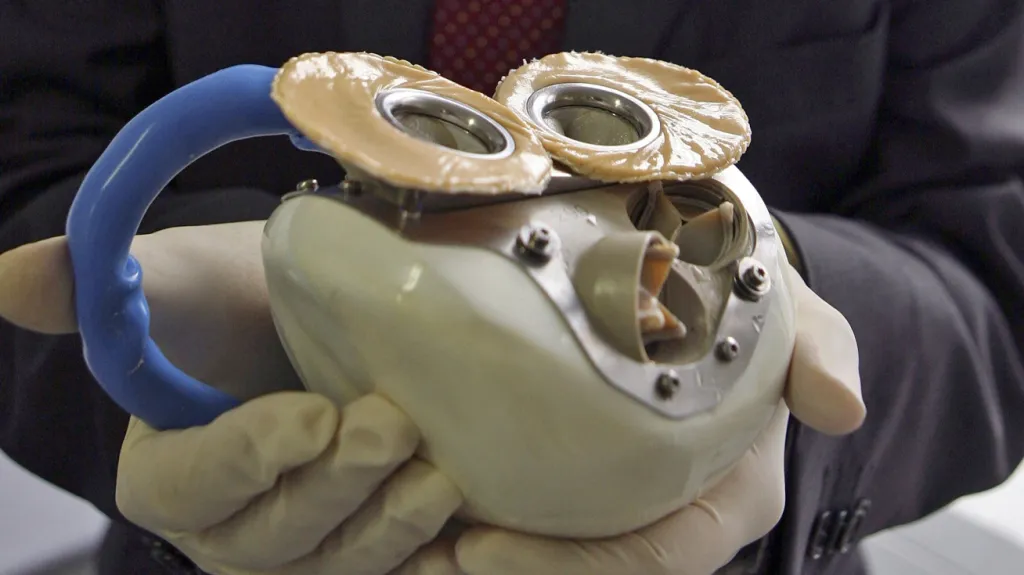 Umělé srdce společnosti Carmat