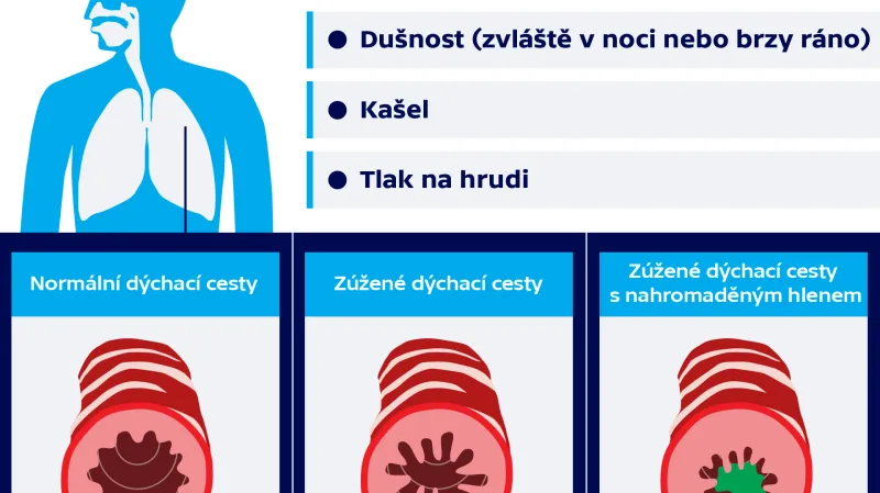 Běžné příznaky astmatu