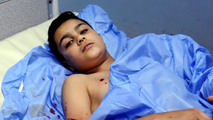 Zraněný syrský chlapec