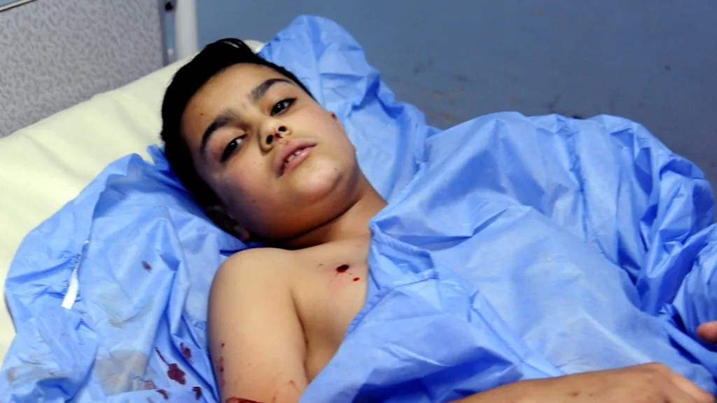 Zraněný syrský chlapec