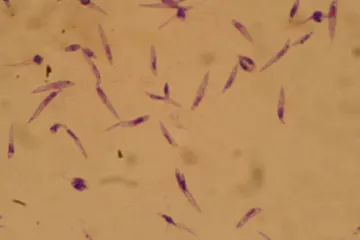 Čeští vědci hledají vakcínu proti smrtící černé horečce způsobené exotickým parazitem