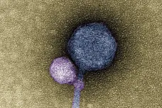 Vědci poprvé popsali černého pasažéra mezi viry. Parazituje na jiném, používá ho jako beranidlo