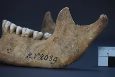 Archeologové našli nejstarší známou oběť moru. Muž zemřel po kousnutí krysy před 5300 lety