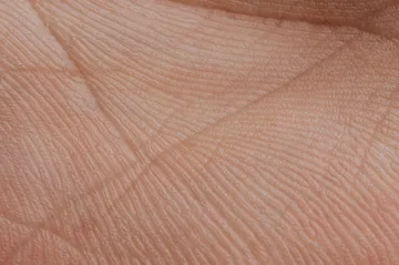 Čeští lékaři pracují na systému, který vyčenichá kožní nemoci