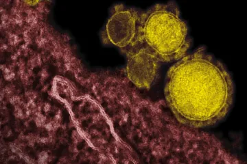 Nový koronavirus, SARS a MERS. Tři epidemie 21. století se liší smrtností, úmrtností i vlastnostmi virů