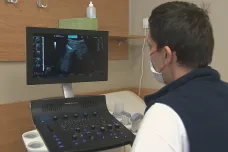 Praktičtí lékaři usilují o využití ultrazvuku a možnost předepisovat širší spektrum medikamentů