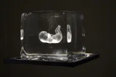 Co je to sklo? Křehkost embrya, společné sukulenty i glycerinové vztahy